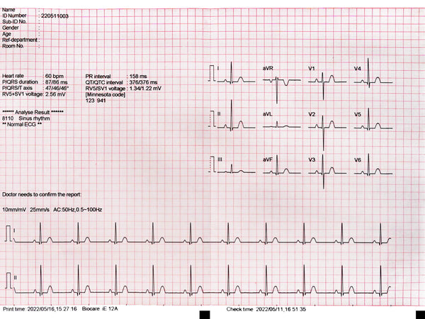 Biocare iE12A ECG Paper (3 packs) - MDcubes