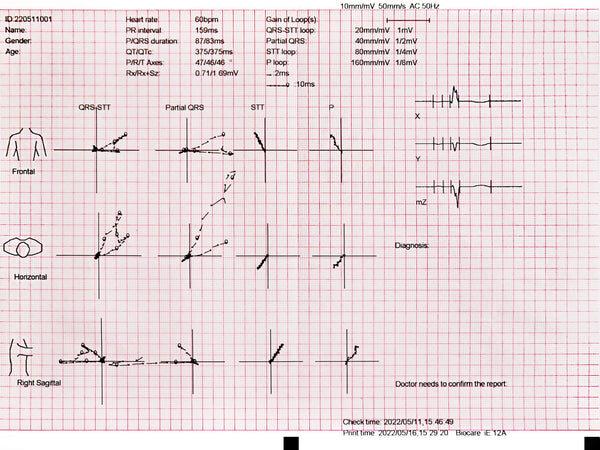 Biocare iE12A ECG Paper (3 packs) - MDcubes