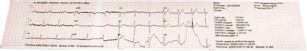 Biocare iE300 ECG Thermal Paper (5 rolls) - MDcubes